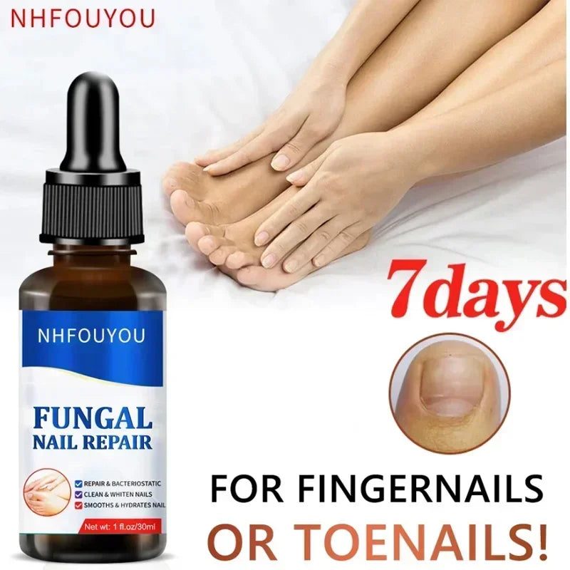 Nail Fungus Treatment Stop Fungal Growth Effective Fingernail 10ml